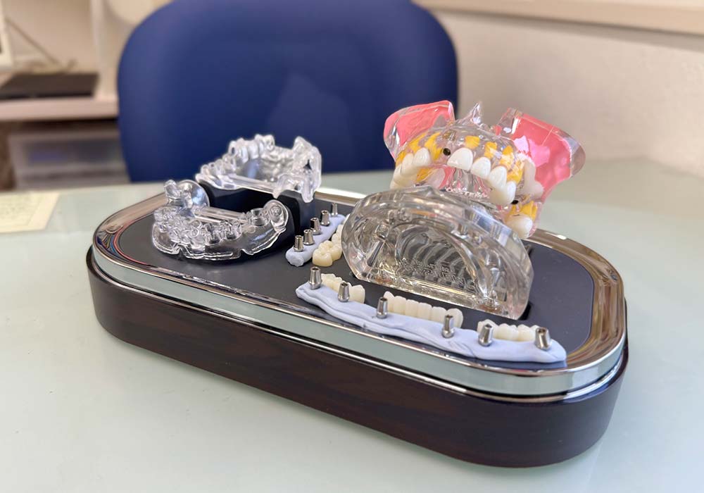 安心・精密な治療を支える「ガイドシステム」