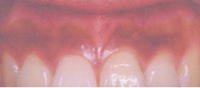 a̎R@@zCgjO@VszCgjO@cӎszCgjO@@KzCgjOO