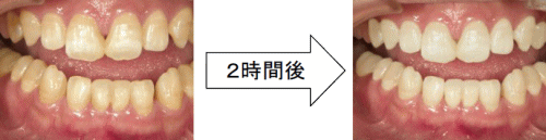 和歌山 日高町 ホワイトニング 御坊市ホワイトニング 田辺市ホワイトニング 流れ